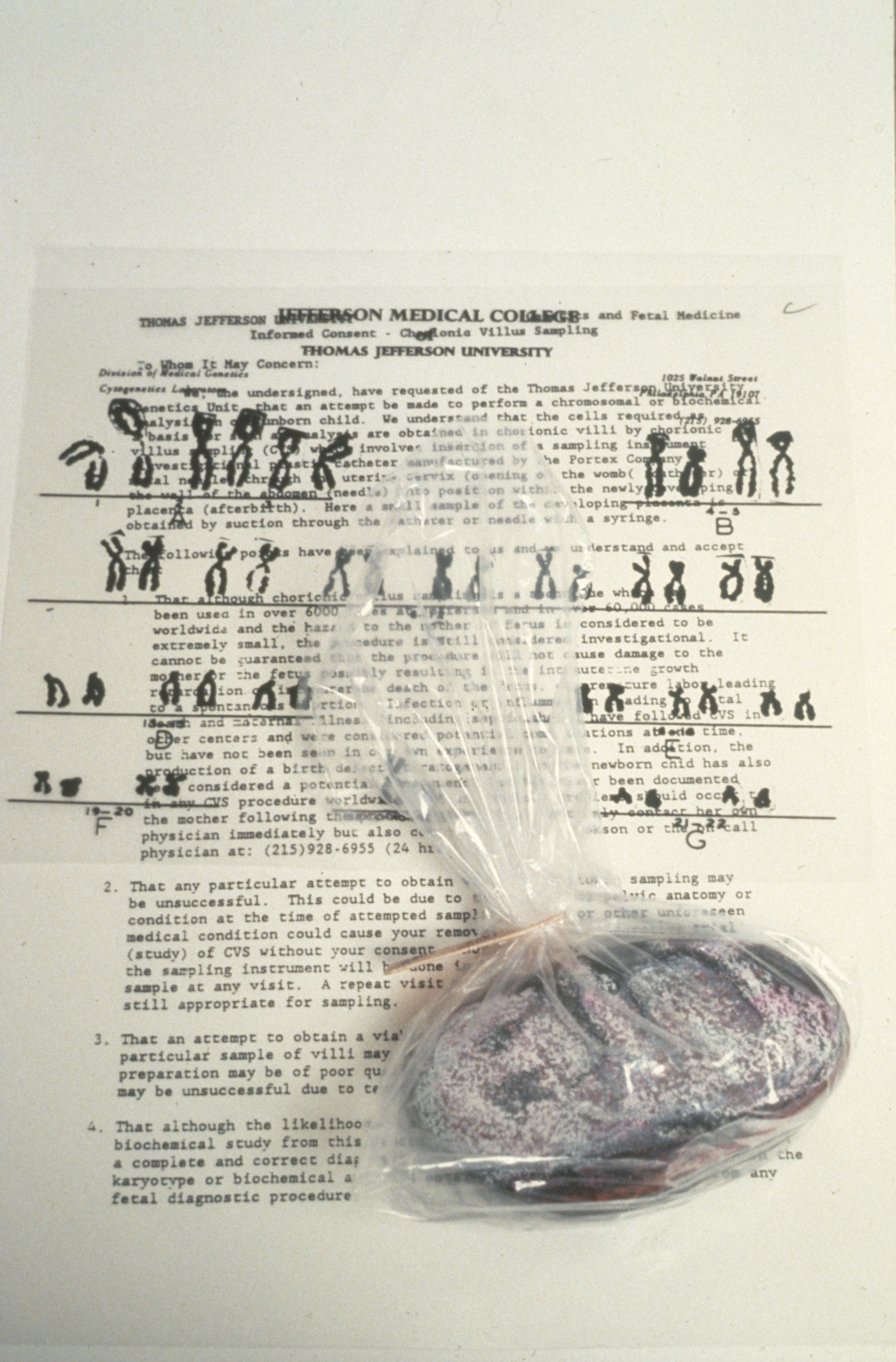 Rock 1.2 — Results for DNA Trisomy