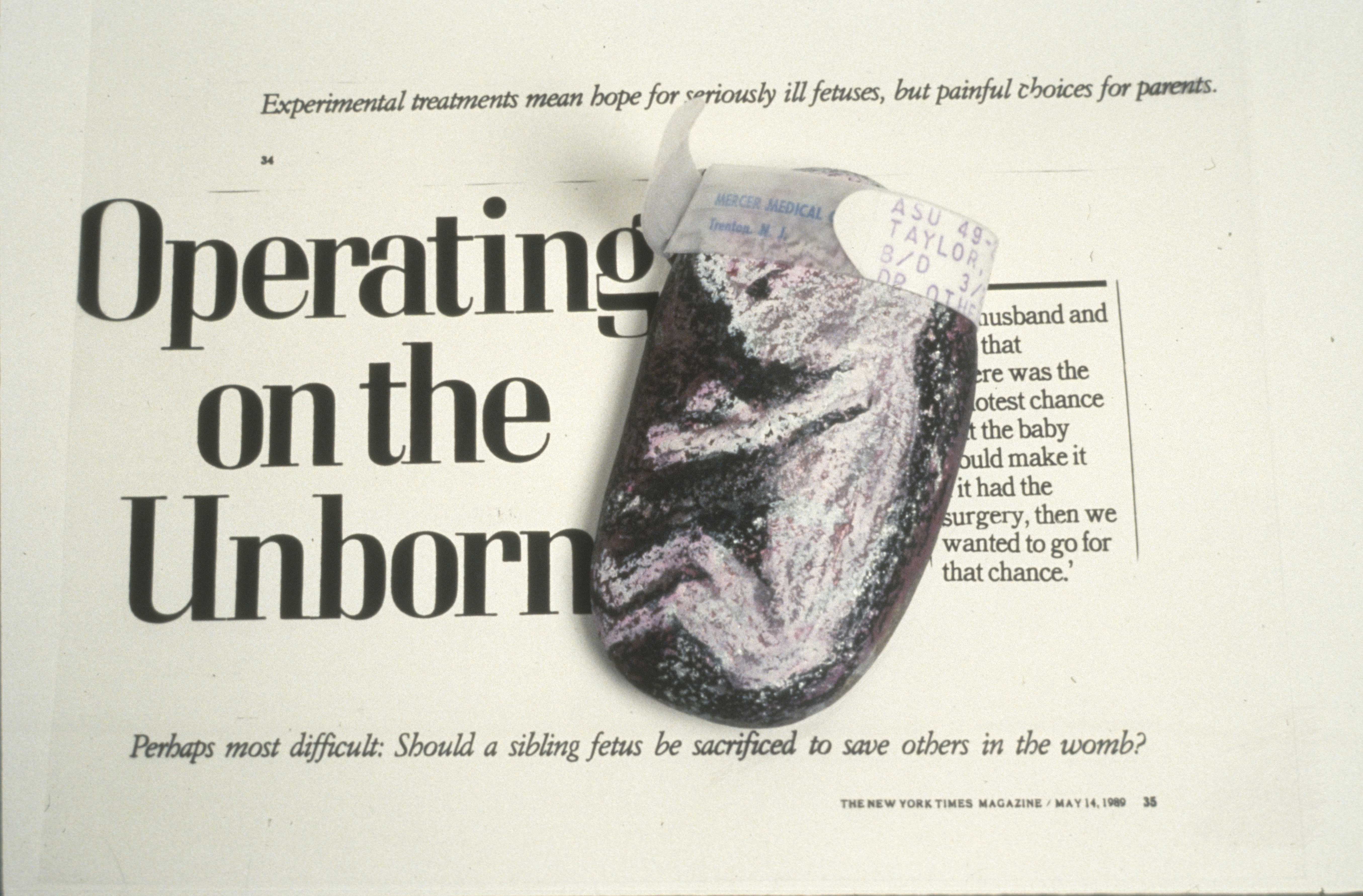Rock 1.3 — Treating the Fetus