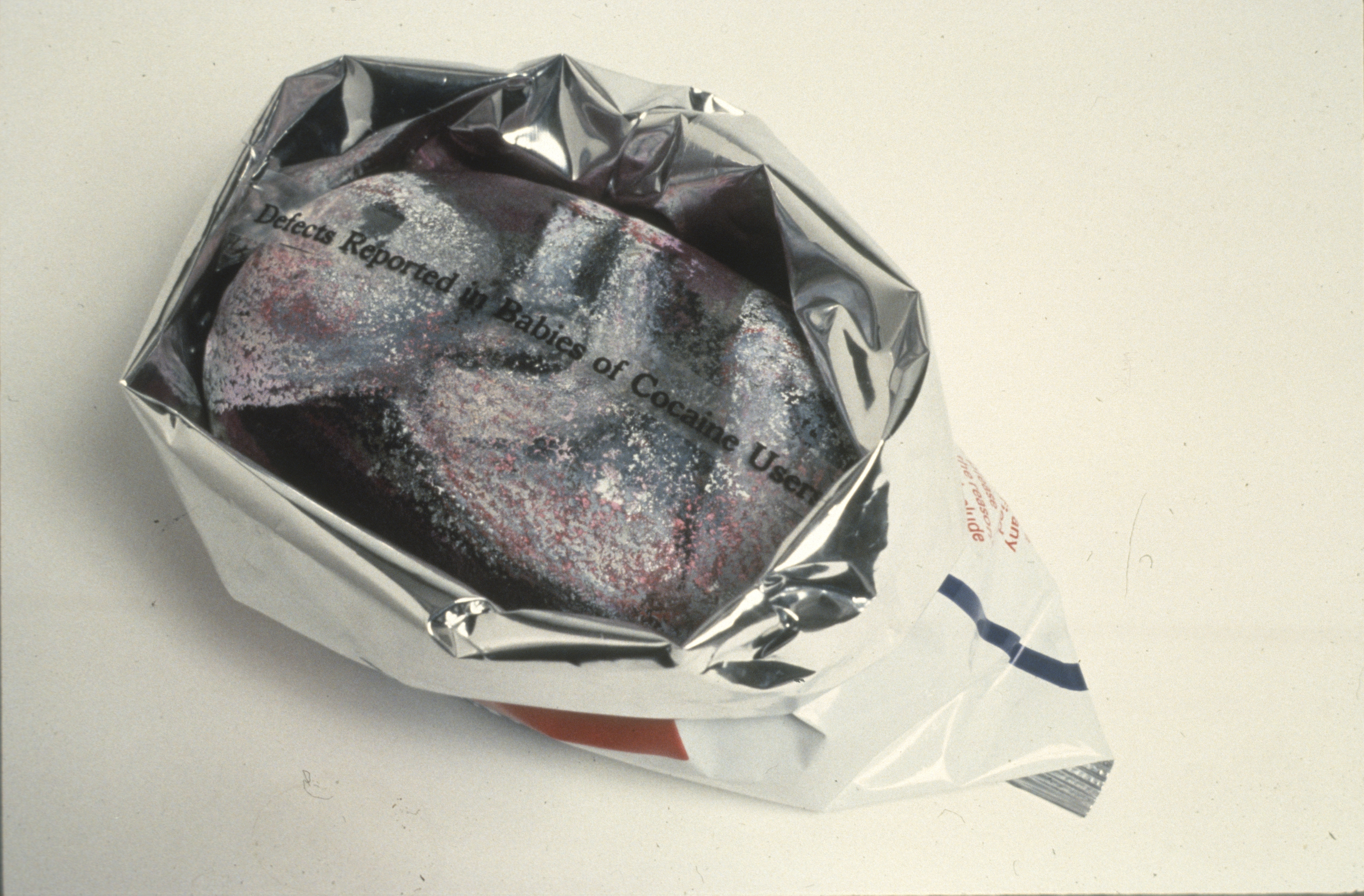 Rock 1.4 — Defects Reported in Babies of Cocaine Users